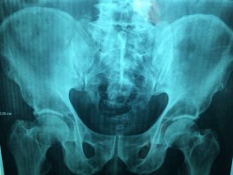 Afdeling radiologie verdwijnt bij gezondheidscentrum Da Costa